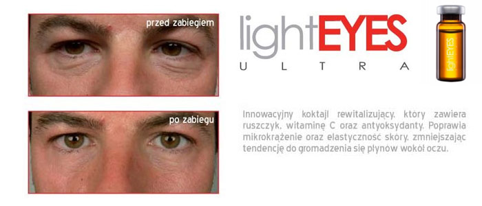 Light Eyes na cienie pod oczami