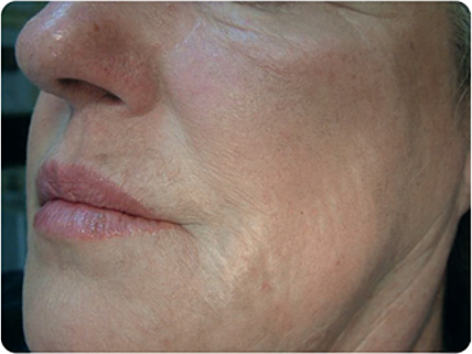 profilo rezultaty74 after