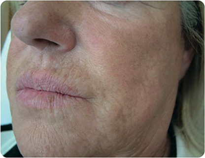 profilu rezultaty74 before