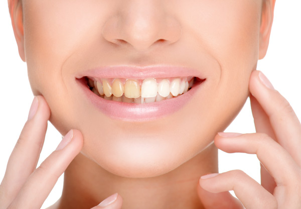 Wybielania Zębów PureLite