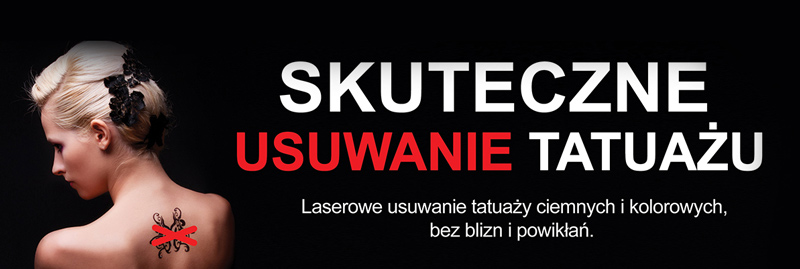 Usuwanie tatuaży